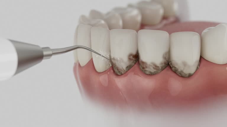 Reliable Dental Implants contractor in Abbeville, LA by Smile Center Dentistry